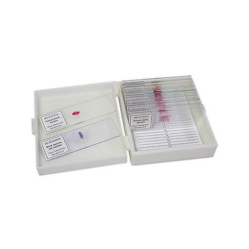 Mitosis Permanent Slide 1 Set