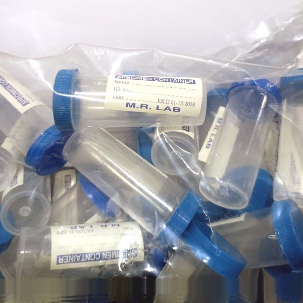 Urine Collection Pot Sample Collection Container 100 Pcs